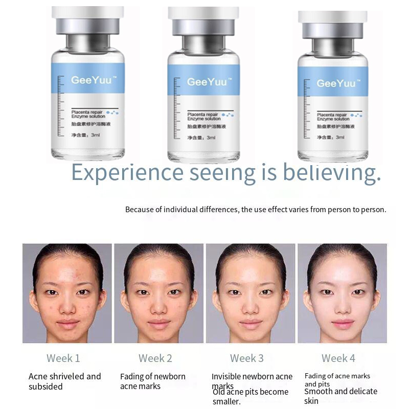 Placent Peptide Ampoule Hyalur - Placenta Extract Serum のレビューと価格