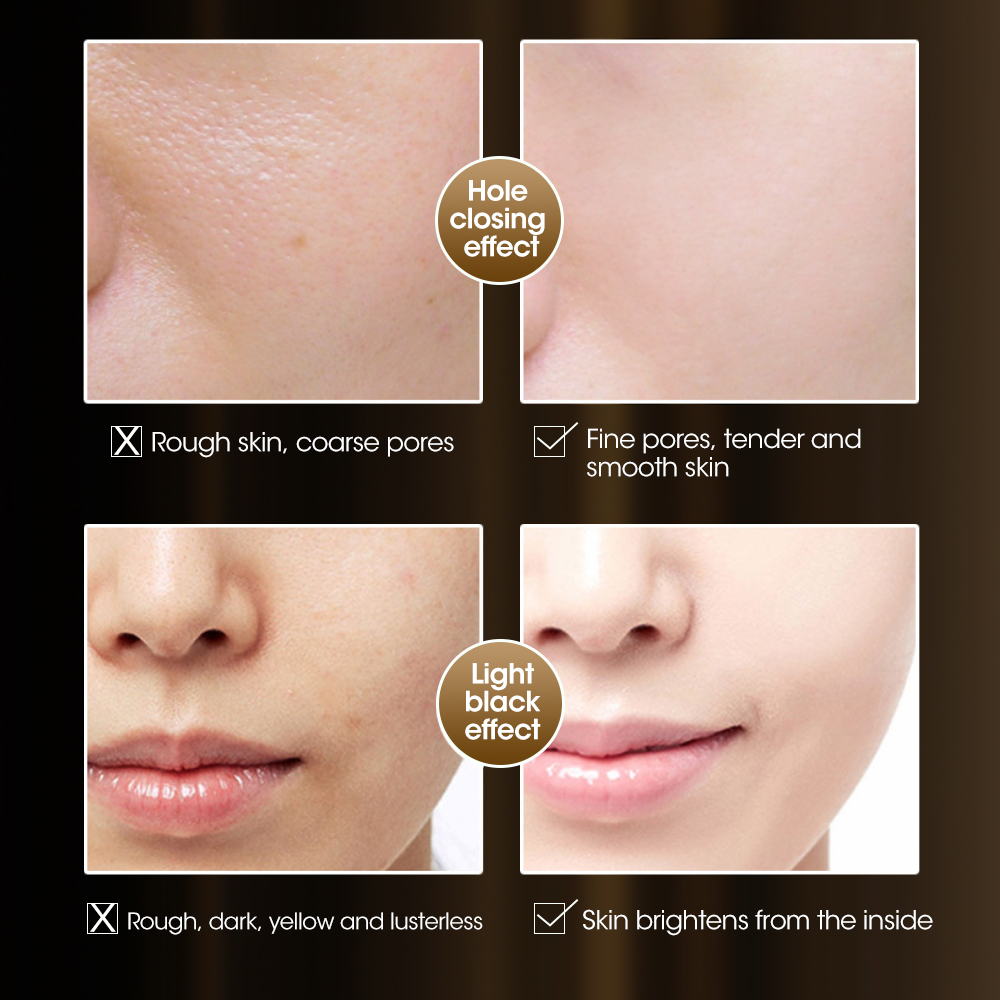 30/60PCS Fullerene Placenta Ca - Placenta Extract Serum のレビューと価格