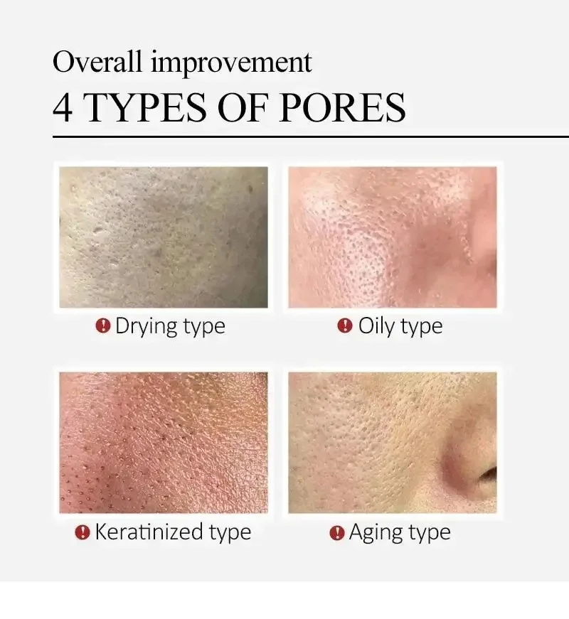 Centella Asiatica Shrink Pores - Luxury Skincare Korea のレビューと価格