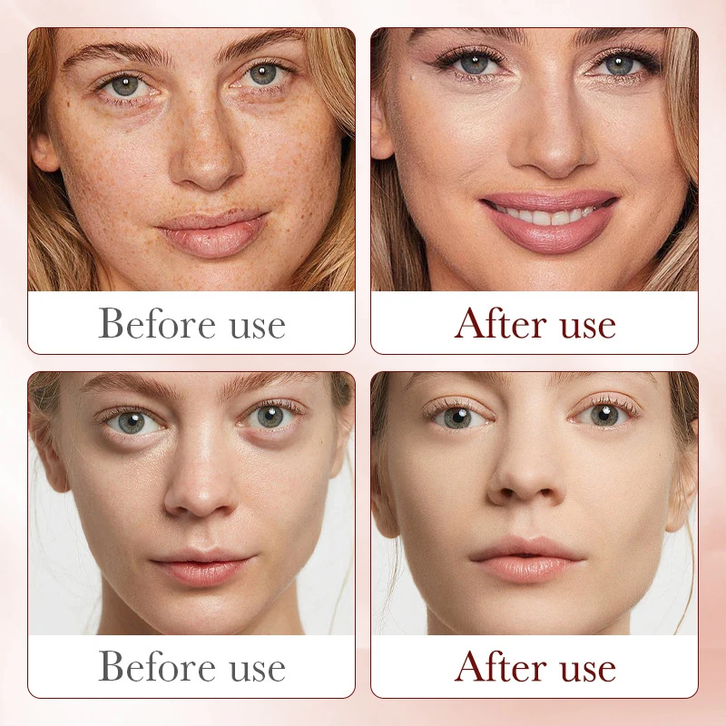 Royal Dragon Blood Serum Place - Placenta Extract Serum のレビューと価格